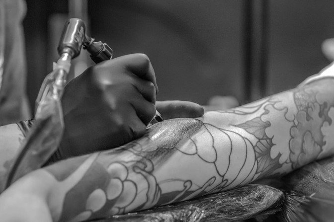 5 Important Tips That Will Help You Recover From Tattoo Removal